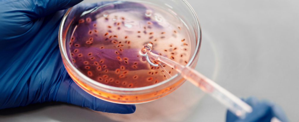 Brain-Eating Amoeba: What Canadians Need to Know