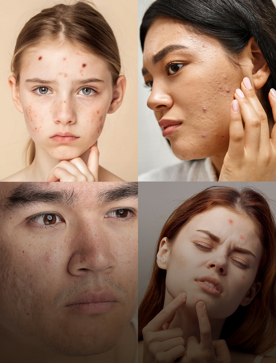 How to Make Rice Water for Skin: A Comprehensive Guide