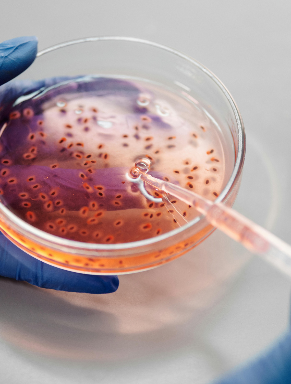 Brain-Eating Amoeba: What Canadians Need to Know